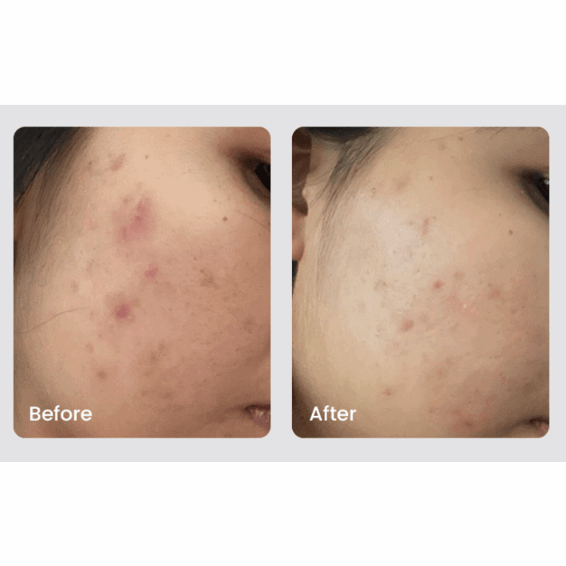 Ciel Divonne AXIS-Y dark spot correcting glow serum 50 ml