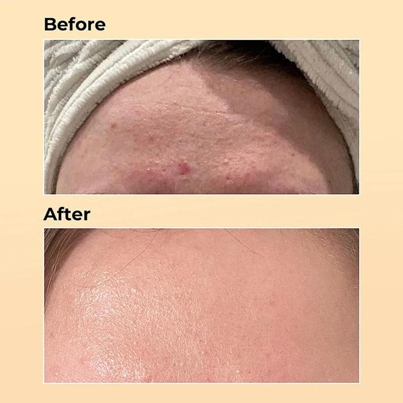 Ciel Divonne COSRX advanced snail 96 mucin power essence-100 ml